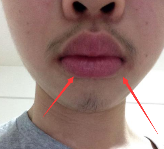 2提示——嘴唇发麻