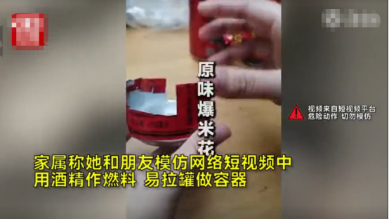 女孩模仿视频炸爆米花 2斤酒精爆炸 全身96 特重度烧伤