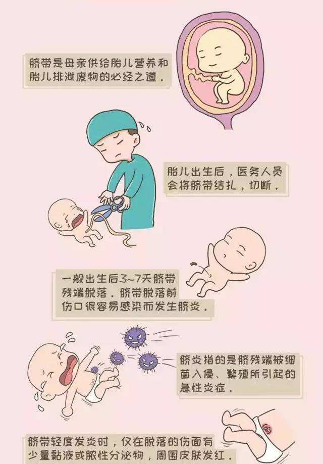 给新生儿脐带消毒图解图片