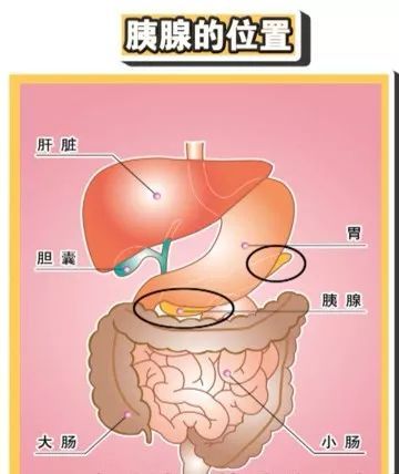 急性胰腺炎的疼痛劇烈,且一般持續不緩解.