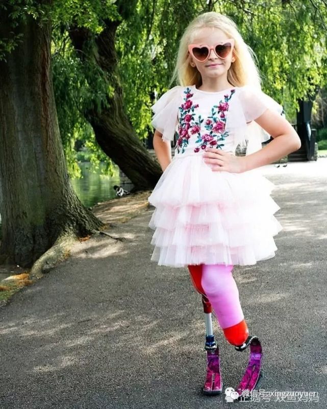 天生双腿畸形截肢,追梦9岁无腿女孩成名模踏上纽约时装周