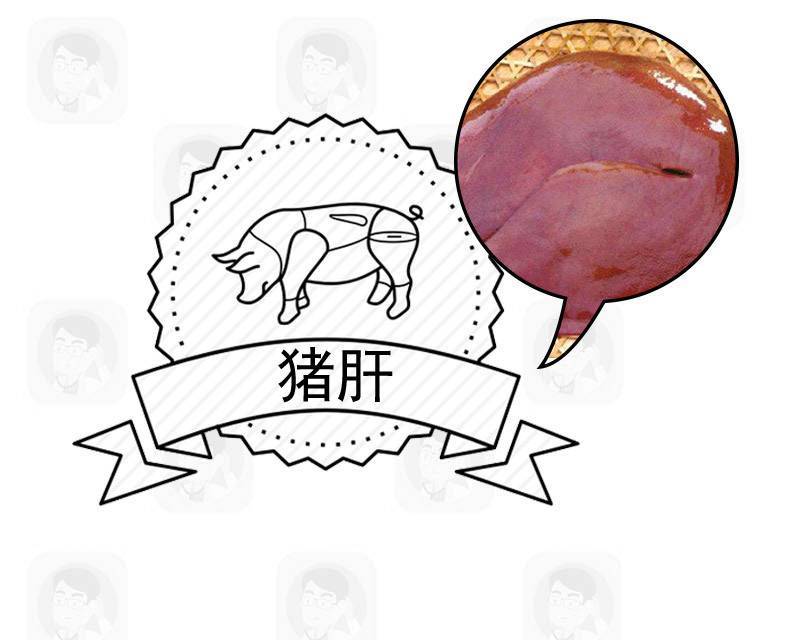 高血脂|明明很瘦却查出高血脂？提醒：饮食不注意4点，血脂难降下来