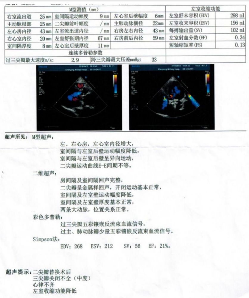 ▎ 心脏超声:左室射血分数(lvef)21%.