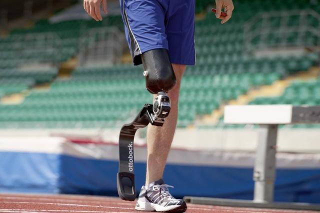 假肢脚的几种常见类型介绍