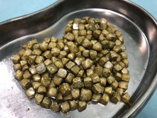 胆囊切除后对身体会有哪些影响 还能不能吃肉和鸡蛋了 告诉你 鸡蛋 胆囊 胆囊结石