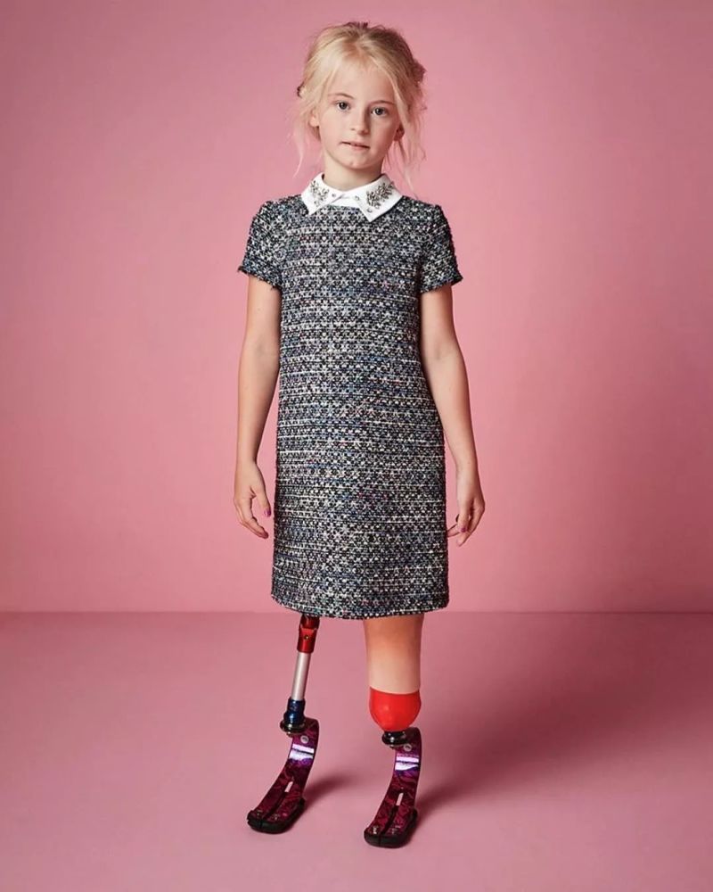 "无腿"模特进军巴黎时装周,不认命的女孩才最美!