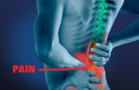 腰痛可不都是腰间盘 医生提醒 5种类型 分清才能彻底治好
