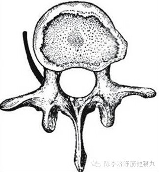 腰椎间盘突出症|腰椎间盘膨出、突出、脱出，都需要治疗吗？