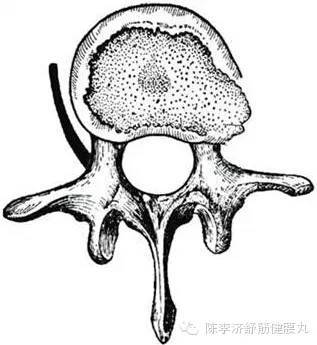 腰椎间盘突出症|腰椎间盘膨出、突出、脱出，都需要治疗吗？