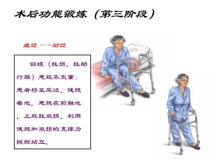 骨折术后的康复功能锻炼含上肢下肢