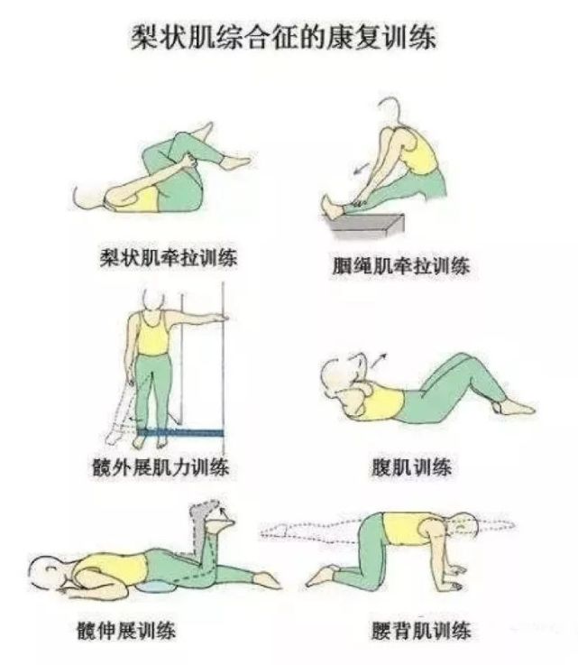 提示不是所有的坐骨神经痛都是腰突,其中就有骨盆倾斜导致的梨状肌