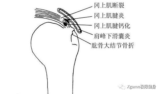 别再这样做侧平举了