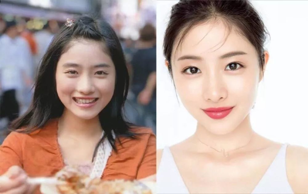 新垣結衣整形 Aquarhead