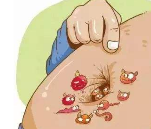 肚脐眼里的"泥"究竟是什么,能抠吗?为了健康,请你手下留情!
