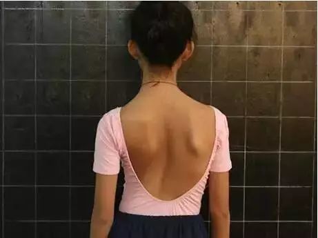 孩子站没站相坐没坐相要警惕颈椎侧弯毁终生