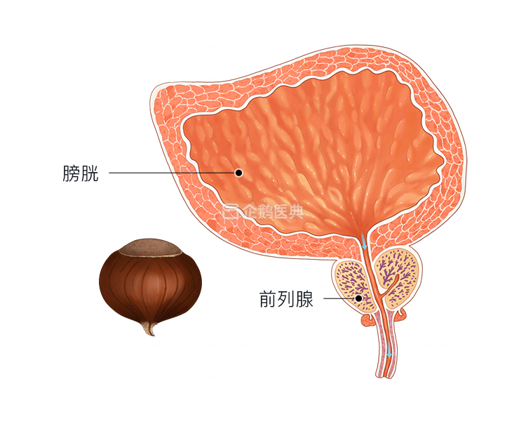 前列腺是人體內較小的一個器官,成人的前列腺僅有 20 克,就是這個板栗