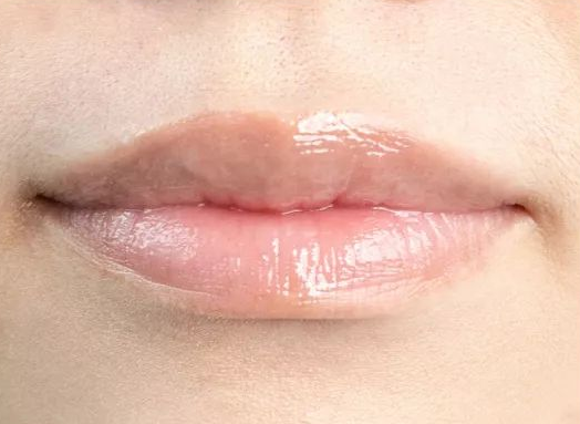 嘴唇起皮不只因为干燥,还可能是过敏?三种方法教你恢复嘴唇滋润