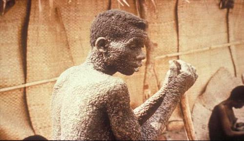 这种病毒曾杀死2亿人!曾被视为超级武器,如今随爆炸或再次扩散