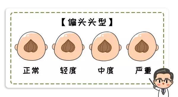 脸不对称 视听障碍 多多重视宝宝头型吧 腾讯新闻