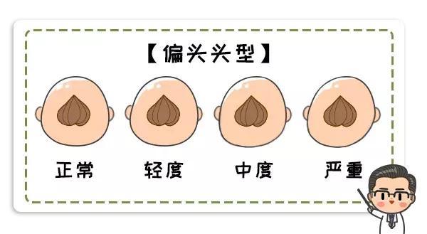 脸不对称 视听障碍 多多重视宝宝头型吧 腾讯新闻