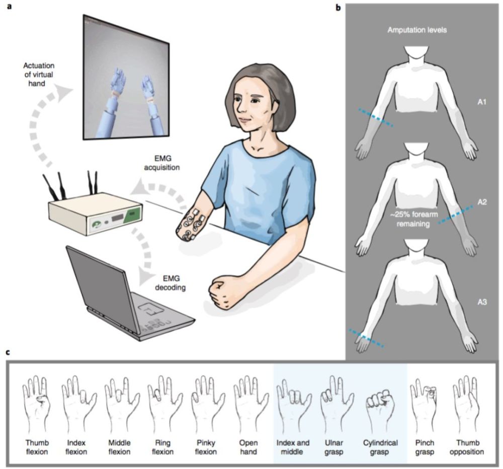 解析肌电信号,用智能义肢控制单个手指,nature子刊报道!