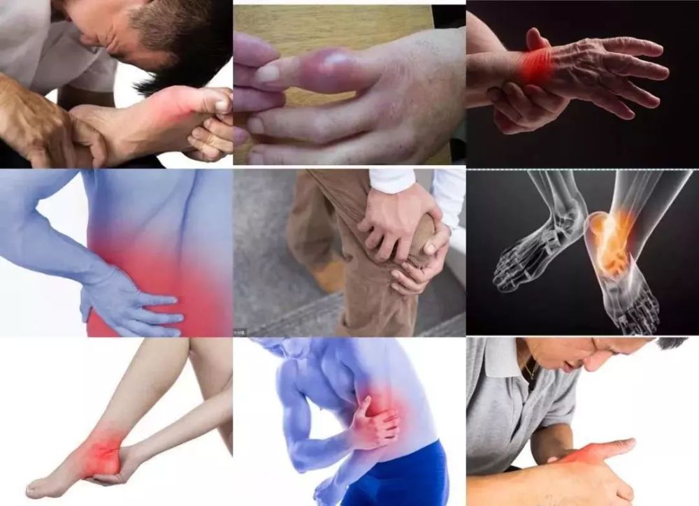 又被戏称为 "痛风套餐" 再加上缺少运动,经常熬夜 导致血液中的尿酸不