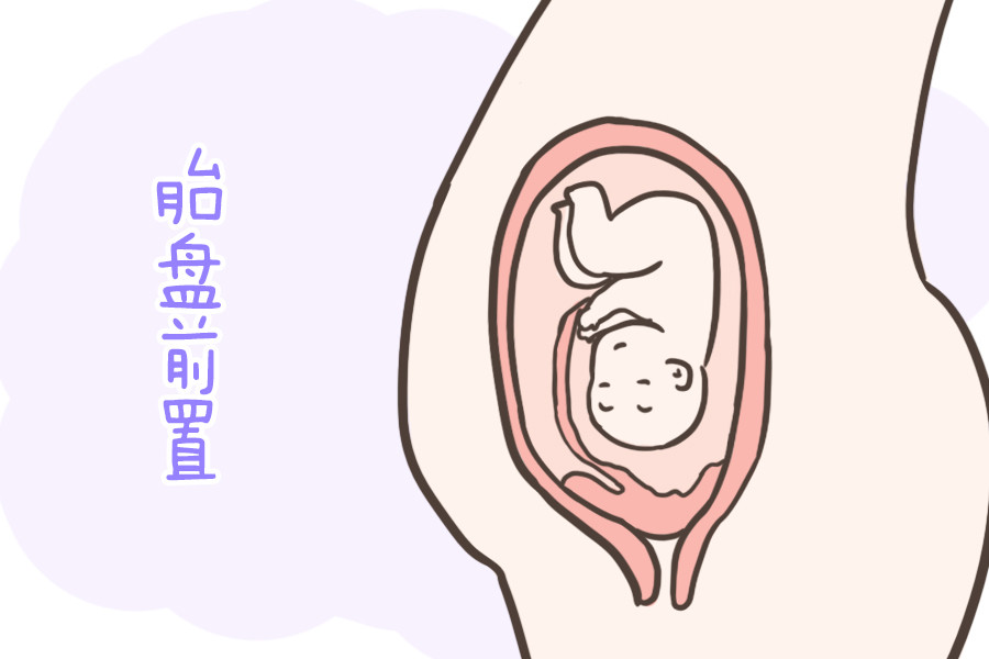 孕妈胎盘前壁和后壁有什么区别?