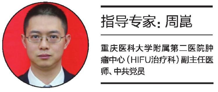 (上游新闻记者  周晋羽)硬纤维瘤是一种局部侵袭性的非转移性肿瘤,因