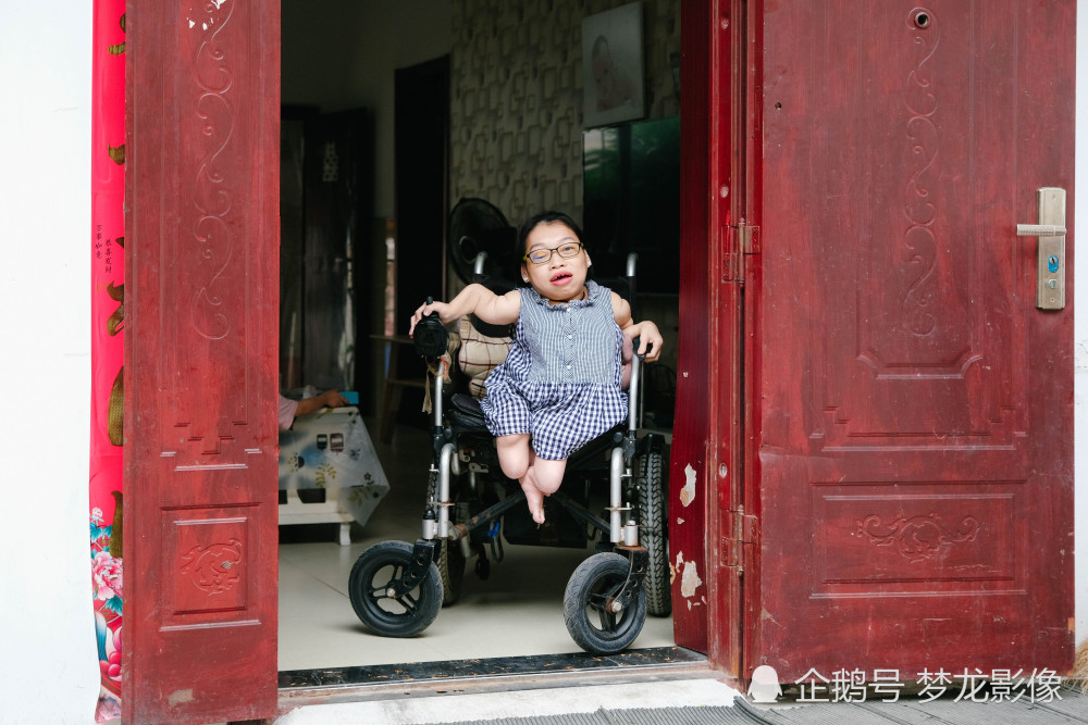 89厘米熊猫血瓷娃娃搏命生女,丈夫说出事先保妻,如今娃若天仙