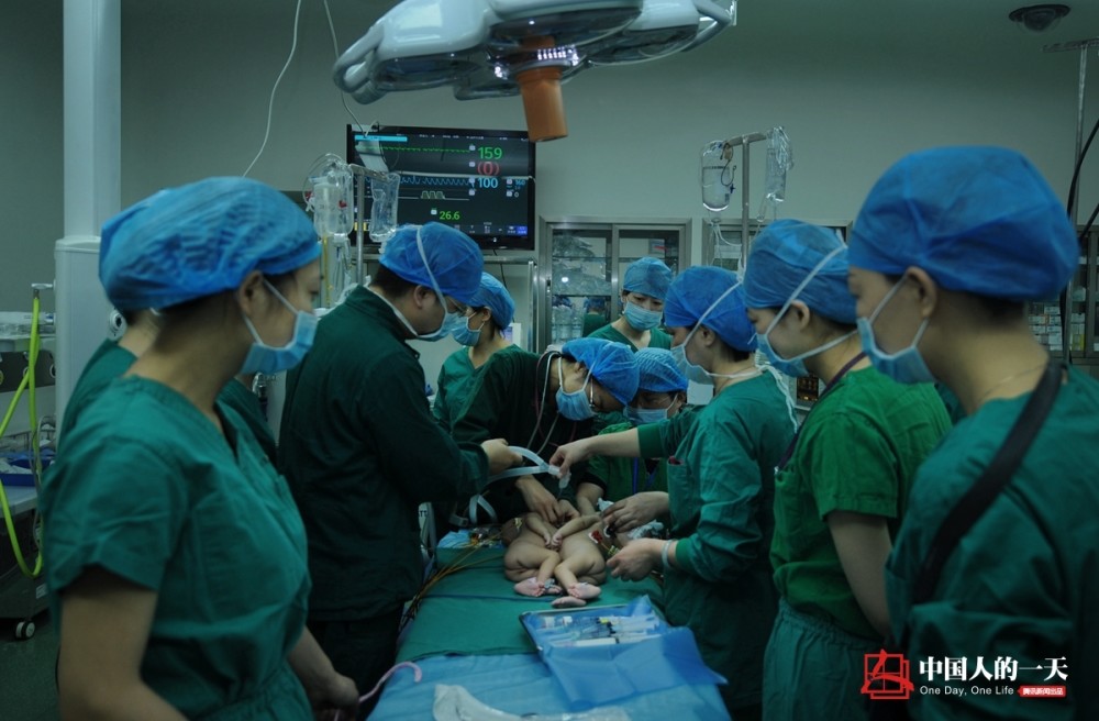 湖南首例成功分离连体婴儿长大了!10岁姐妹花爱吃辣学习好_腾讯新闻