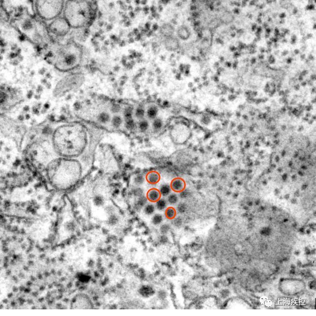 登革热|预防登革热，防蚊灭蚊是关键