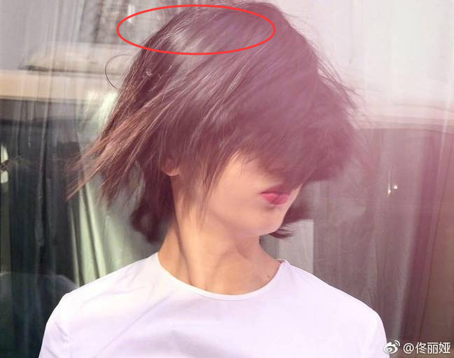 佟丽娅35岁白头发严重脸颊凹瘦脸色苍白没人疼太心酸