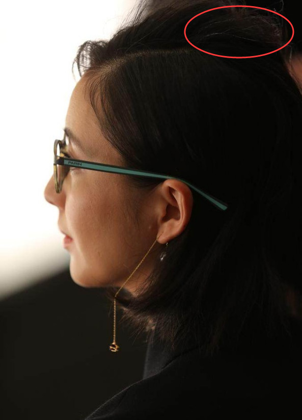 佟丽娅35岁白头发严重脸颊凹瘦脸色苍白没人疼太心酸