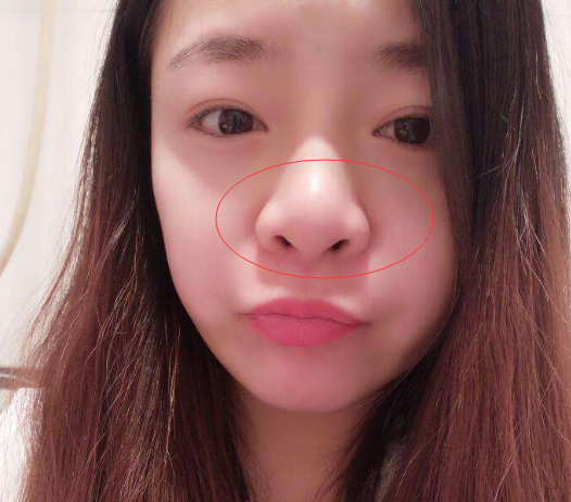 青春期女生嫌鼻子丑?3招变成好看的"水滴鼻",班花都想跟着学