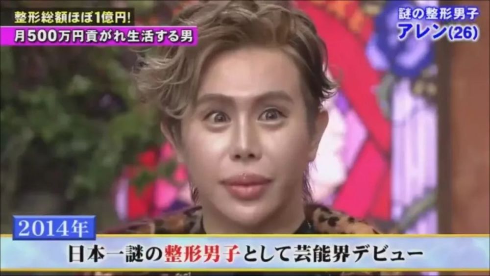 视角丨日本最强软饭男花1亿整容 每月500万零花 网友 还不如不整
