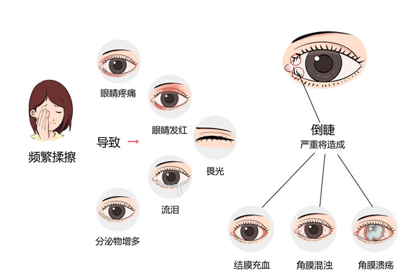 如何判断是倒睫