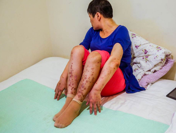 如何辨别身边艾滋病携带者遇到这3类人劝你擦亮双眼