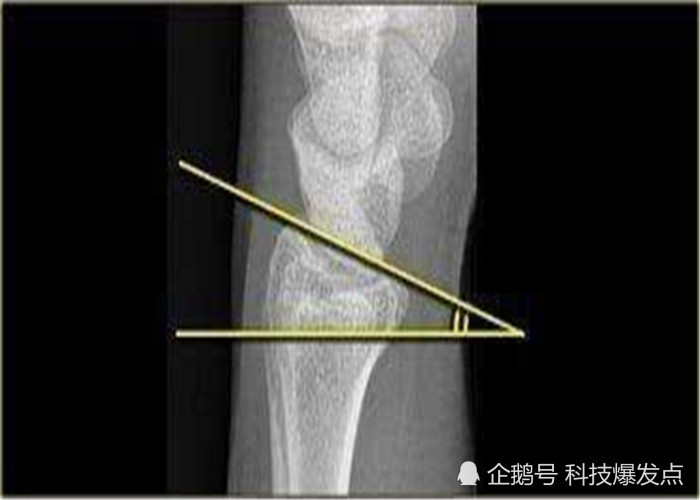 人类在百万年进化中消失的功能再次出现身体发生了突变