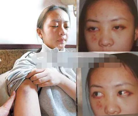 曾惨遭张国立儿子家暴的童谣,嫁了个哈佛大学毕业的富商!