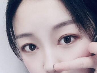 割双眼皮平行还是扇形好 腾讯新闻