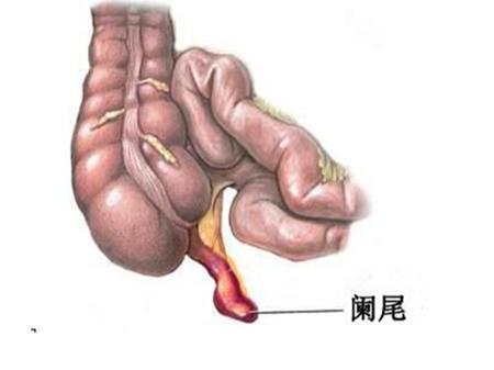但最近的研究表明,阑尾可能保护"有益"细菌的安全.