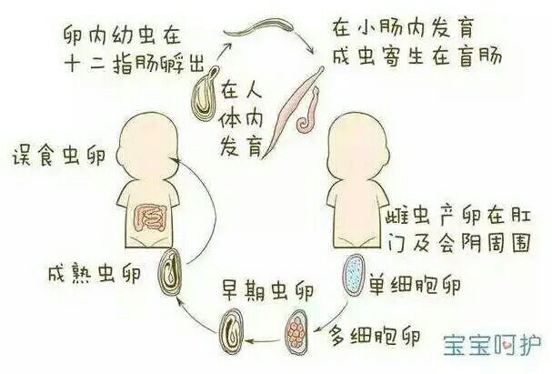 更新治疗中的儿童蛲虫病