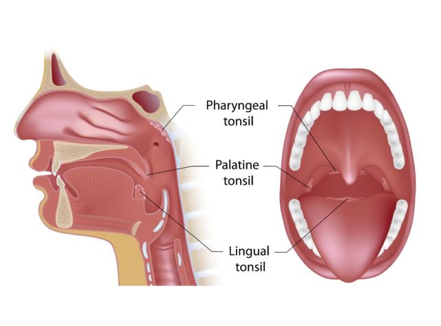 其中咽扁桃体只在儿童时期可以看得到,成人以后基本看不到;腭扁桃体是