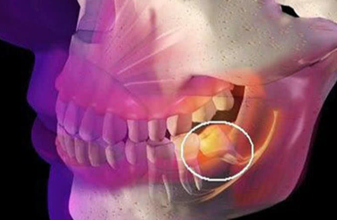 原来人体这些器官是多余的,尤其第3个,被称为