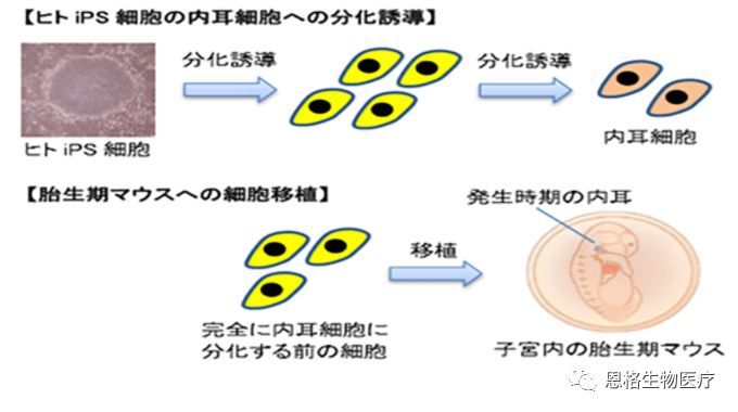 Ips细胞新研究揭开遗传性耳聋成因 盘点ips细胞这几年都 腾讯新闻