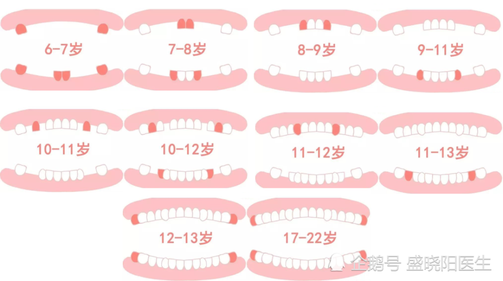孩子几岁应该换牙?