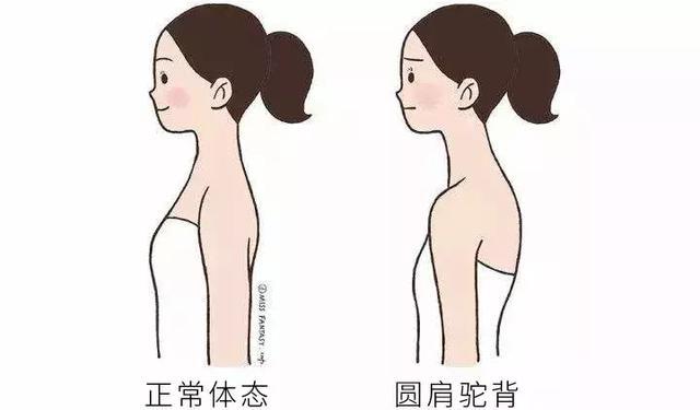 正美体态:就是要让你直!