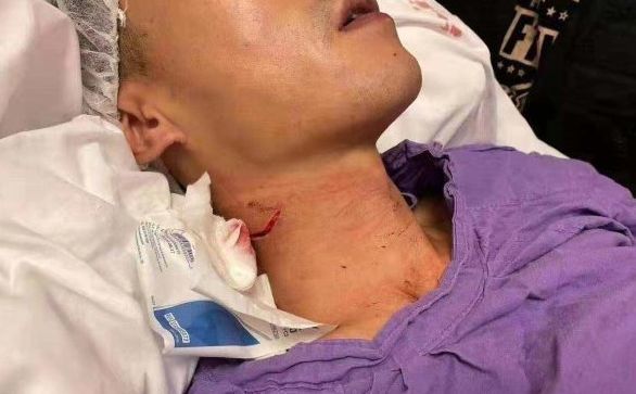 香港首现遥控炸弹19岁割喉袭警学生被捕