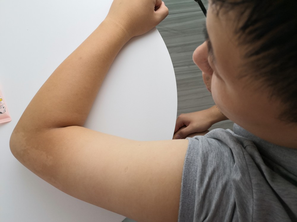 美白不能只管脸 身体护理也很重要 跟我这么做 告别熊猫肌 腾讯新闻