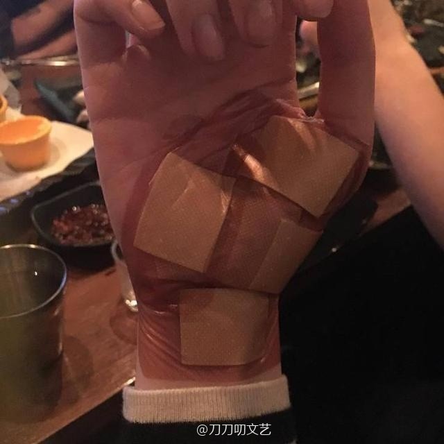 这令人回想起2016年,崔雪莉曾因手腕包扎而被传出自残的新闻,当时也许